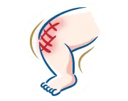 淺談腹絞痛：徵狀、成因及舒緩方法